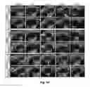 Fig. 08 - Bi-Layer Extra Cellular Matrix Scaffolds and Uses Therefor