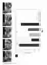 Fig. 10 - Bi-Layer Extra Cellular Matrix Scaffolds and Uses Therefor