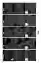 Fig. 12 - Bi-Layer Extra Cellular Matrix Scaffolds and Uses Therefor