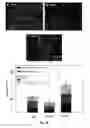 Fig. 18 - Bi-Layer Extra Cellular Matrix Scaffolds and Uses Therefor