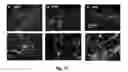 Fig. 20 - Bi-Layer Extra Cellular Matrix Scaffolds and Uses Therefor