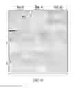 Fig. 18 - Biodegradable hydrogel for tissue expansion