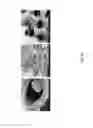 Fig. 12 - Microcapillary network based scaffold