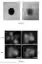Fig. 06 - Three dimensional microtissue bioprinter