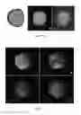 Fig. 09 - Three dimensional microtissue bioprinter