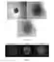 Fig. 10 - Three dimensional microtissue bioprinter