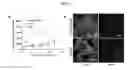 Fig. 13 - Injectable, flexible hydroxyapatite-silk foams for osteochondral and dental repair