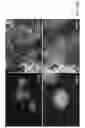 Fig. 31 - MESENCHYMAL CELL-BINDING COMPOSITE MATERIAL FOR TISSUE RESTORATION