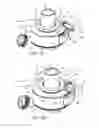 Fig. 11 - Ventricular cuff