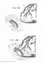 Fig. 13 - Ventricular cuff