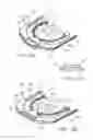 Fig. 17 - Ventricular cuff