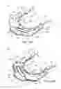 Fig. 35 - Ventricular cuff