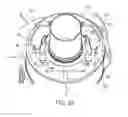 Fig. 37 - Ventricular cuff
