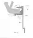 Fig. 55 - Ventricular cuff