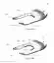Fig. 75 - Ventricular cuff