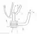 Fig. 01 - Heart pump device and method for operating same
