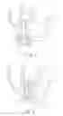 Fig. 02 - Heart pump device and method for operating same