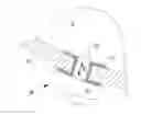 Fig. 01 - Minimally invasive methods and devices for ventricular assist device implantation