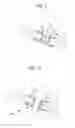 Fig. 07 - Minimally invasive methods and devices for ventricular assist device implantation