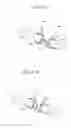Fig. 08 - Minimally invasive methods and devices for ventricular assist device implantation