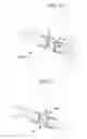 Fig. 09 - Minimally invasive methods and devices for ventricular assist device implantation