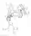 Fig. 02 - Removable transmission for use with a powered surgical tool, the transmission shaped to extend above the tool, and system