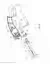 Fig. 08 - Removable transmission for use with a powered surgical tool, the transmission shaped to extend above the tool, and system