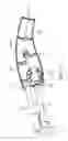 Fig. 09 - Removable transmission for use with a powered surgical tool, the transmission shaped to extend above the tool, and system