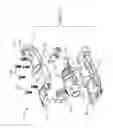 Fig. 14 - Removable transmission for use with a powered surgical tool, the transmission shaped to extend above the tool, and system