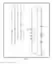 Fig. 02 - INFUSION SET