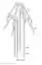 Fig. 16 - Rectal Injection Device And Method Of Operation Thereof