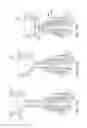 Fig. 20 - Rectal Injection Device And Method Of Operation Thereof