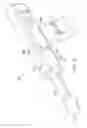 Fig. 28 - Rectal Injection Device And Method Of Operation Thereof