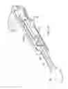 Fig. 40 - Rectal Injection Device And Method Of Operation Thereof