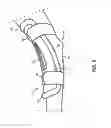 Fig. 05 - Elbow Braces for Intravenous Therapy and Related Methods