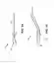 Fig. 11 - Elbow Braces for Intravenous Therapy and Related Methods