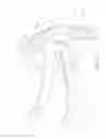 Fig. 44 - Mask system with snap-fit shroud