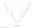 Fig. 76 - Mask system with snap-fit shroud
