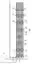 Fig. 08 - Segmented MRI catheters and other interventional devices