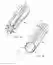 Fig. 05 - Introducer sheath having expandable portions