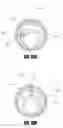 Fig. 12 - Inventory sparing catheter system