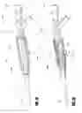 Fig. 18 - Inventory sparing catheter system