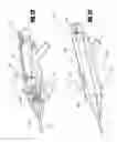 Fig. 20 - Inventory sparing catheter system