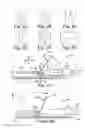Fig. 04 - SYSTEM FOR SECURING MULTI-LUMEN MEDICAL ARTICLES
