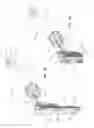 Fig. 02 - Medical inflation systems and methods