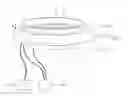 Fig. 01 - MEDICAL DEVICE FOR GENERATING ULTRASONIC WAVES AND ELECTRICAL STIMULATION SIGNAL