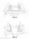 Fig. 08 - Support Garment for a Wearable Medical Device