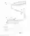Fig. 02 - Electrical stimulation leads and systems with elongate anchoring elements and methods of making and using