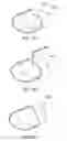 Fig. 20 - Establishing continuity between a shield within an implantable medical lead and a shield within an implantable lead extension