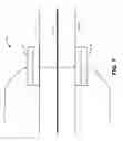 Fig. 06 - SYSTEMS AND METHODS FOR TRANSCUTANEOUS DIRECT CURRENT BLOCK TO ALTER NERVE CONDUCTION